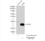 RTN3 Antibody in Immunoprecipitation (IP)