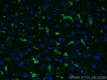 CD163 Antibody in Immunohistochemistry (PFA fixed) (IHC (PFA))