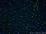 CD163 Antibody in Immunohistochemistry (PFA fixed) (IHC (PFA))