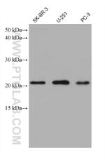 calcyphosine Antibody in Western Blot (WB)