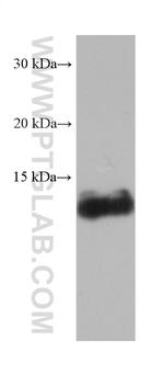FABP1 Antibody in Western Blot (WB)