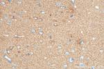 DCLK1 Antibody in Immunohistochemistry (Paraffin) (IHC (P))
