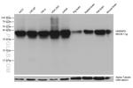 HNRNPD Antibody in Western Blot (WB)