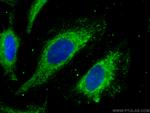 PDHB Antibody in Immunocytochemistry (ICC/IF)