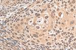 PSMA2 Antibody in Immunohistochemistry (Paraffin) (IHC (P))