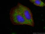 FBXO17 Antibody in Immunocytochemistry (ICC/IF)