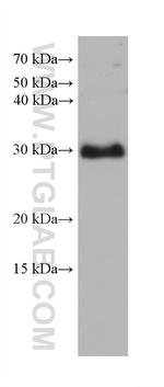 FBXO17 Antibody in Western Blot (WB)