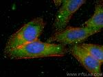 ZER1 Antibody in Immunocytochemistry (ICC/IF)