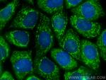 CHCHD3 Antibody in Immunocytochemistry (ICC/IF)