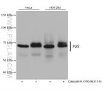 FUS/TLS Antibody in Western Blot (WB)