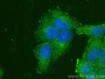 CARD11 Antibody in Immunocytochemistry (ICC/IF)