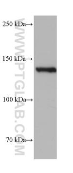 CARD11 Antibody in Western Blot (WB)