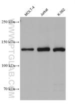 CARD11 Antibody in Western Blot (WB)
