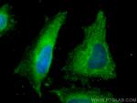 RPS20 Antibody in Immunocytochemistry (ICC/IF)