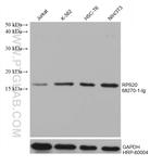 RPS20 Antibody in Western Blot (WB)