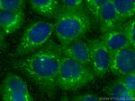 PDXDC1 Antibody in Immunocytochemistry (ICC/IF)