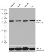 RAD52 Antibody in Western Blot (WB)