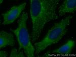 RABEP1 Antibody in Immunocytochemistry (ICC/IF)