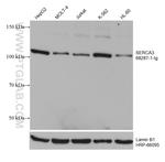 SERCA3 Antibody in Western Blot (WB)