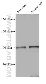 SERCA3 Antibody in Western Blot (WB)