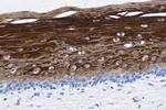 Cytokeratin 6 Antibody in Immunohistochemistry (Paraffin) (IHC (P))