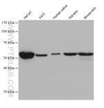 Cytokeratin 6 Antibody in Western Blot (WB)