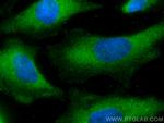 PAK4 Antibody in Immunocytochemistry (ICC/IF)