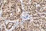 m7G Antibody in Immunohistochemistry (Paraffin) (IHC (P))