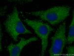MOCS2 Antibody in Immunocytochemistry (ICC/IF)
