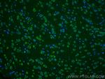 Ataxin 2 Antibody in Immunohistochemistry (PFA fixed) (IHC (PFA))
