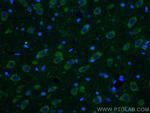 Ataxin 2 Antibody in Immunohistochemistry (PFA fixed) (IHC (PFA))