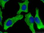 AZI2 Antibody in Immunocytochemistry (ICC/IF)