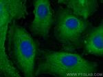 AKR1B10 Antibody in Immunocytochemistry (ICC/IF)