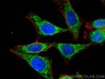NDUFS6 Antibody in Immunocytochemistry (ICC/IF)