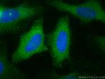 EPS8L2 Antibody in Immunocytochemistry (ICC/IF)