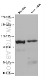 EPS8L2 Antibody in Western Blot (WB)