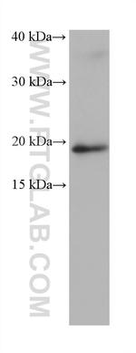 ZNHIT3 Antibody in Western Blot (WB)