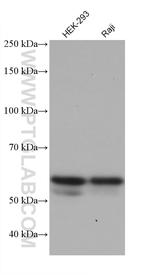 ALAS2 Antibody in Western Blot (WB)