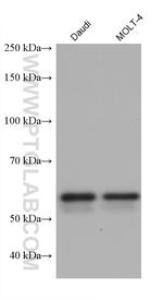 ALAS2 Antibody in Western Blot (WB)