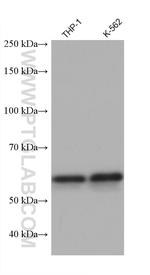 ALAS2 Antibody in Western Blot (WB)