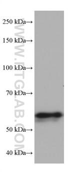 ALAS2 Antibody in Western Blot (WB)