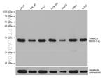TXNDC9 Antibody in Western Blot (WB)