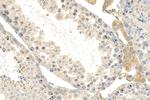 THYN1 Antibody in Immunohistochemistry (Paraffin) (IHC (P))