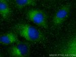 RABL3 Antibody in Immunocytochemistry (ICC/IF)