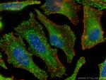 AP2B1 Antibody in Immunocytochemistry (ICC/IF)