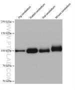 AP2B1 Antibody in Western Blot (WB)