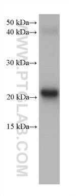 CRYBA2 Antibody in Western Blot (WB)