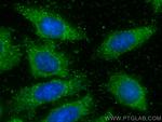 PCYT2 Antibody in Immunocytochemistry (ICC/IF)