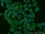 DSP Antibody in Immunocytochemistry (ICC/IF)