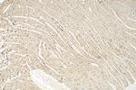 DSP Antibody in Immunohistochemistry (Paraffin) (IHC (P))
